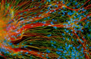 Stem Cell