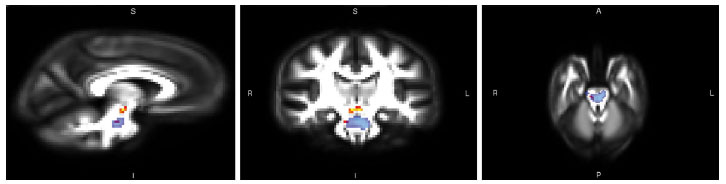 Autism images