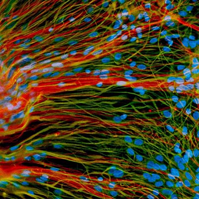 Gene regulating human brain development identified