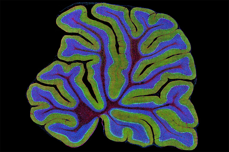 Mining the cerebellum for its role in speech