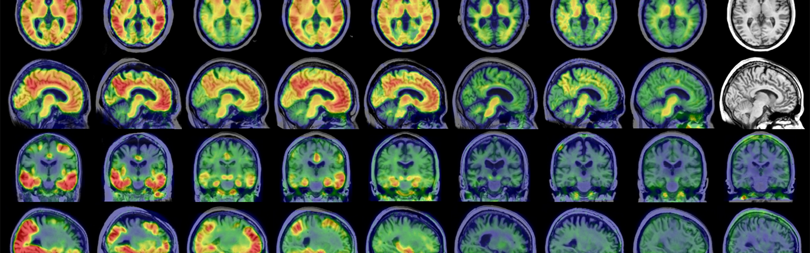 PET scans