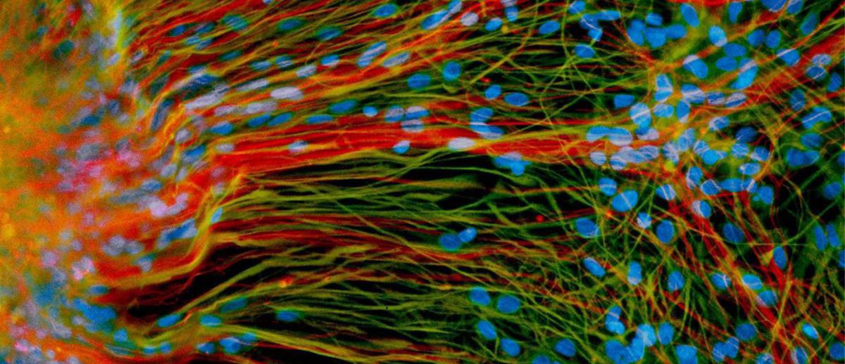 Small miracle: Stem cells drive research and entrepreneurship in Madison