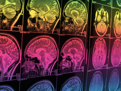 Ed Hubbard and Percival Matthews are collaborating to improve fraction learning through brain imaging.