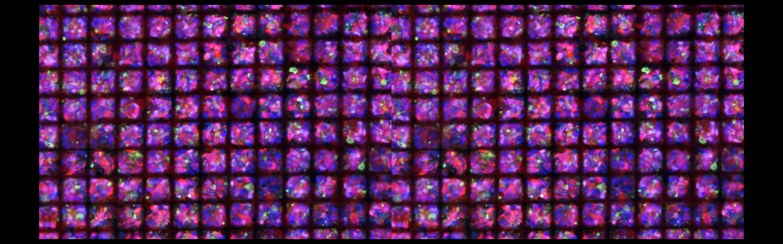 Human pluripotent stem cell-derived photoreceptors (cell bodies labeled in red