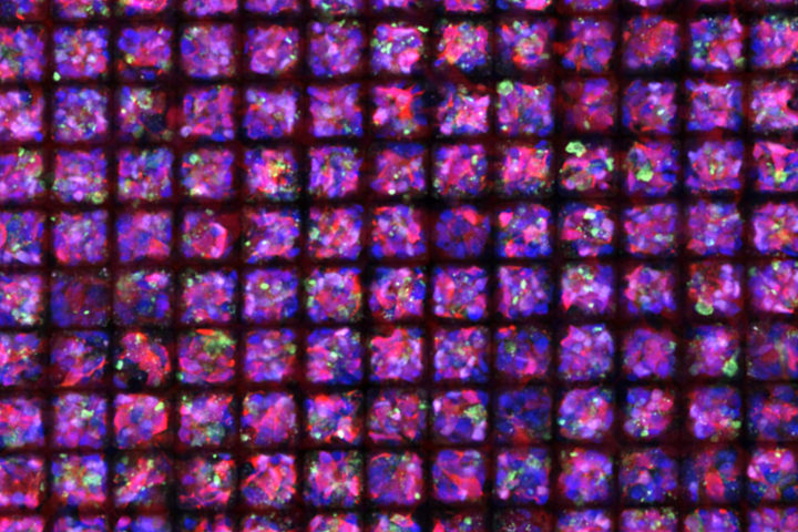 New funding moves David Gamm’s retinitis pigmentosa treatment research into phase two