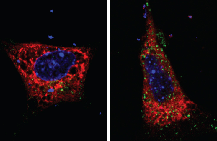 Puglielli research - mice with and without Atase1