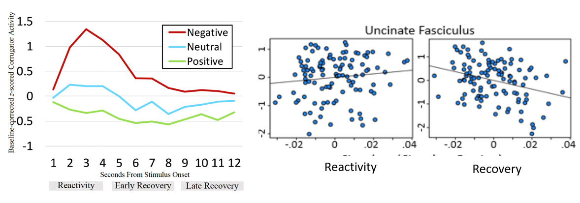 Richard J Davidson, PhD - Slide of the Week
