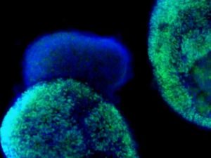 multiple types of retina cells from two types of stem cells