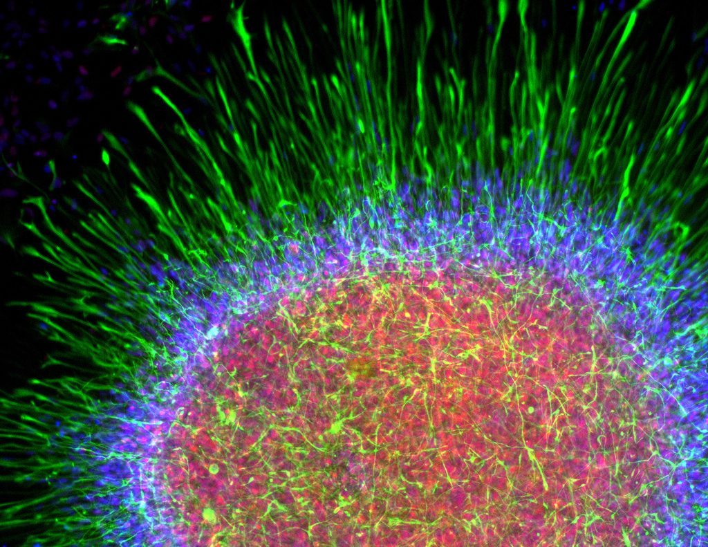 Zhang Astrocyte