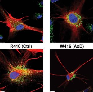 Immunostaining of lysosomes via LAMP2 (green) on 6 month astrocytes