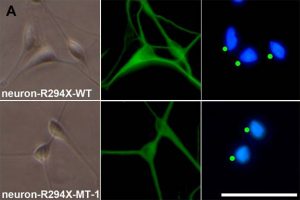 Representative images of neurons derived from iPSCs