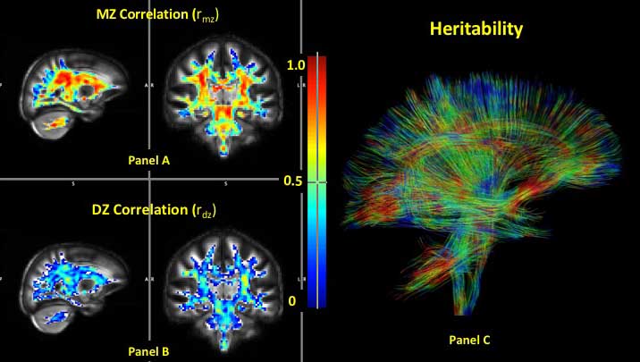 Genetics has a higher influence on brain microstructure development than the environment