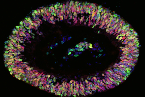 Retinal laminar sphere