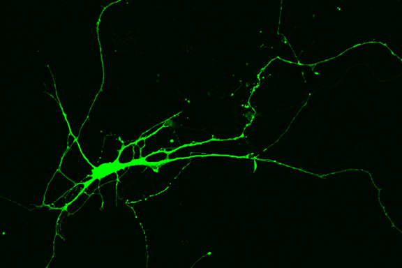 iPS cells from a patient with Rett Syndrome