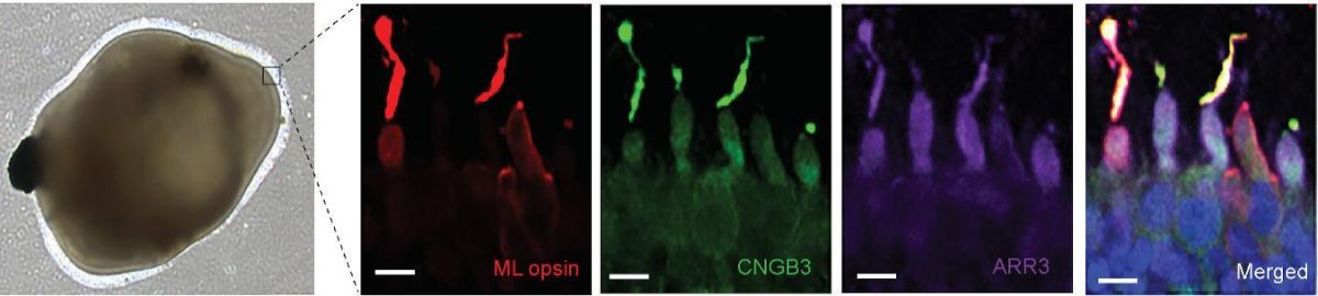 A mature retinal organoid (left) and its cone photoreceptors