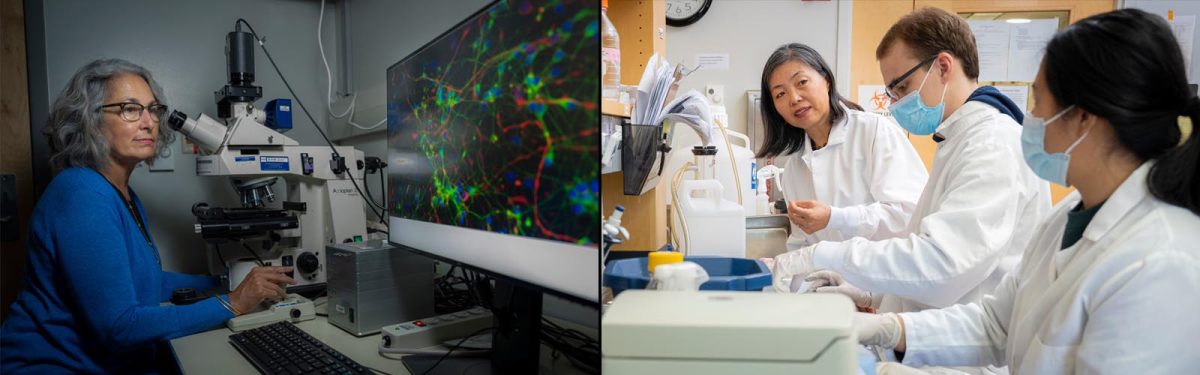 New Department of Defense Grant to Study Fragile X Syndrome in Human Cells