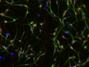 Neurons derived from stem cells of individuals with fragile X syndrome
