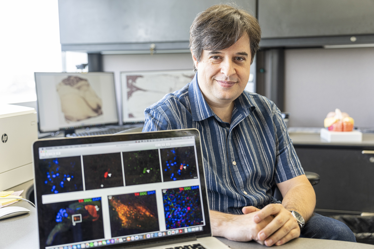 Study shows differences between brains of primates — humans, apes and monkeys — are small but significant