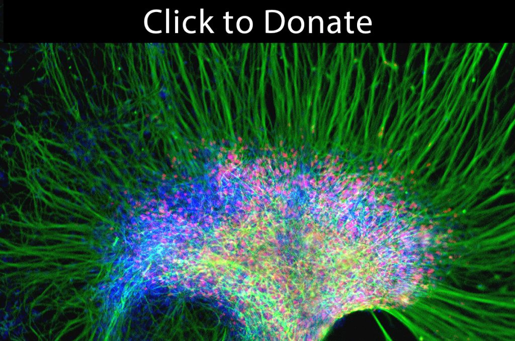 Click to donate