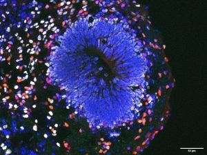 A rosette of an organoid at 14 weeks of differentiation