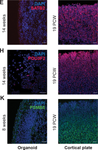 Images of human brain and organoid sections