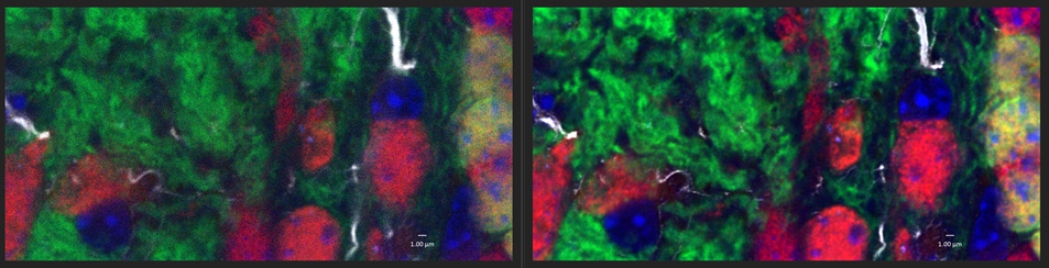 Leica Stellaris 8 Confocal microscope micrograph