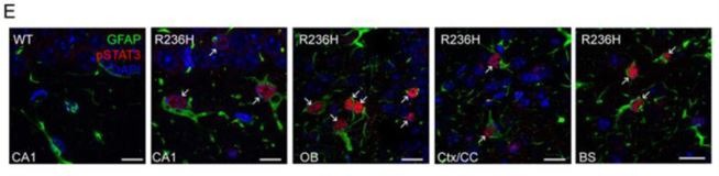 We need to know STAT: Mechanisms behind GFAP accumulation in Alexander disease involve transcription factor STAT3.