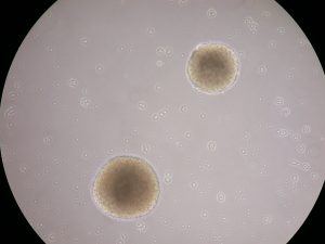 Down syndrome neural progenitor cells which will turn into brain cells/neuron