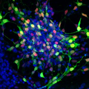 iPS cells were used to create several types of retinal cells in early stage development.