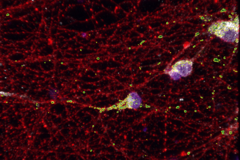 Discovery reveals mitochondria as potential treatment target for fragile X syndrome