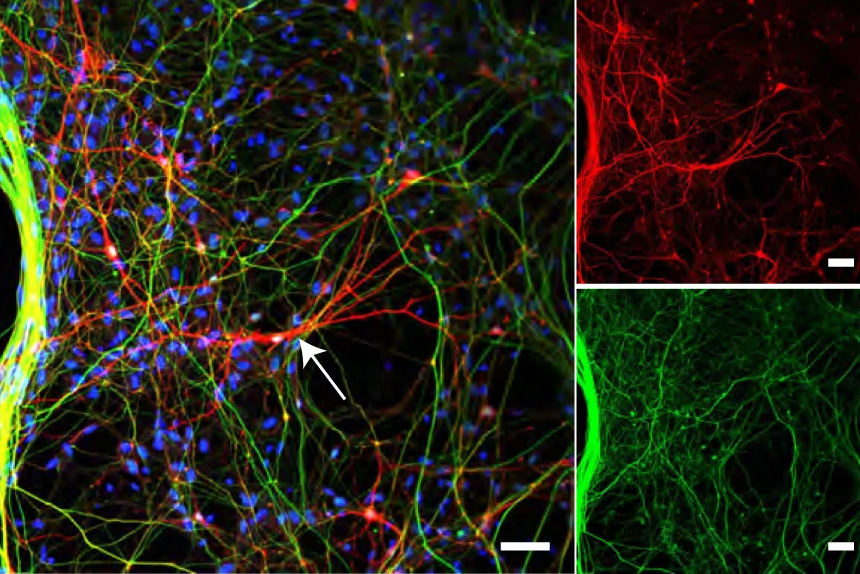 Scientists produce human norepinephrine neurons from stem cells, with significant implications for researching diseases like Alzheimer’s and Parkinson’s