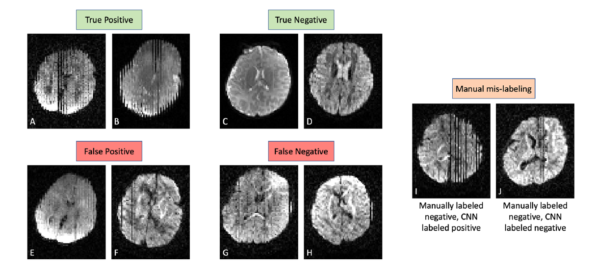 MRI images