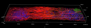 3D-printed functional human brain tissue