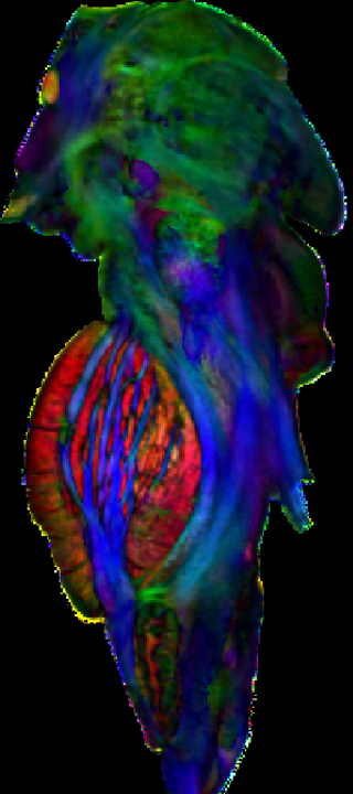 Travers Brainstem Paper