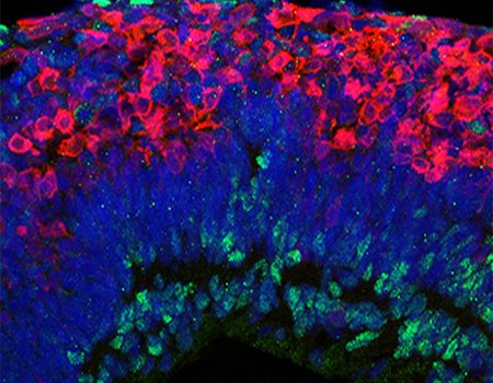 iPS Cells - Gamm Lab