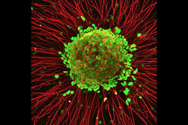 ALS Stem Cell