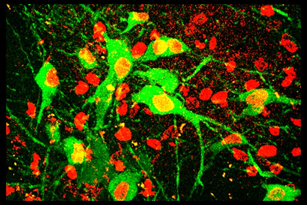 Stem cell