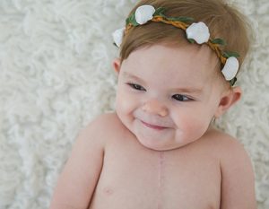 Infant with open heart surgery scar
