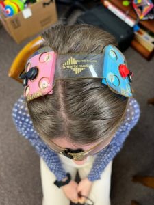 A young girl with transducers - Transcranial Electrical Stimulation