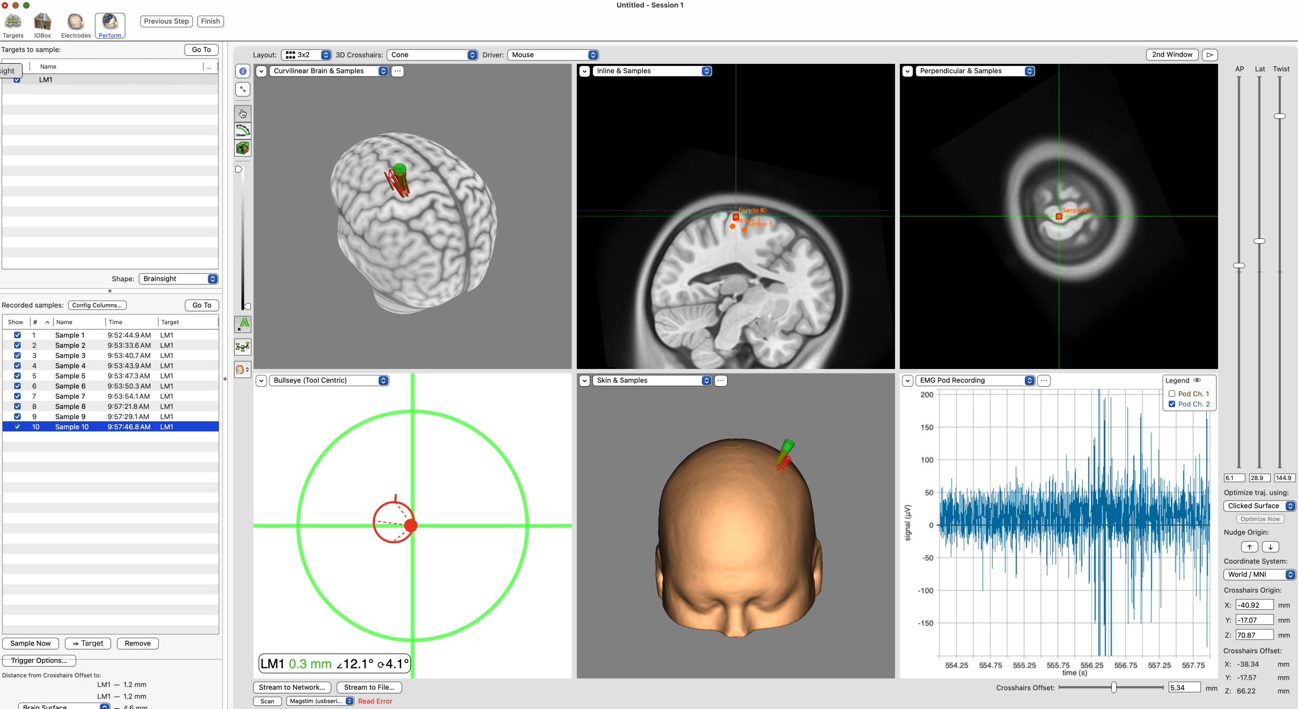 A close up of the Brainsight neuronavigation software. Multiple panels show where in the brain TMS is being applied to. In the bottom corner, a graph shows the participant’s muscle activity recorded from EMG sensors.