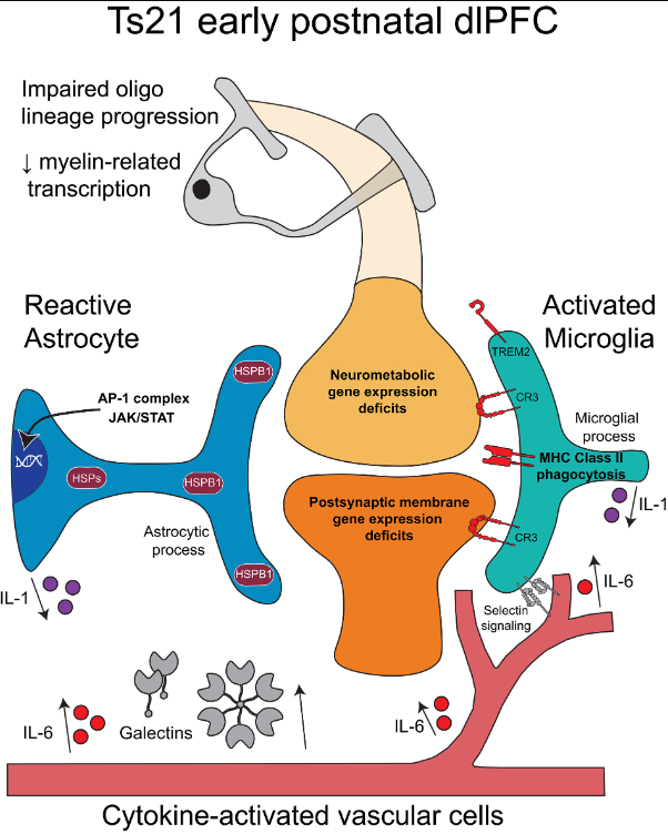 Earliest signs of neurodegeneration in Down syndrome detected shortly after birth, new Waisman study shows