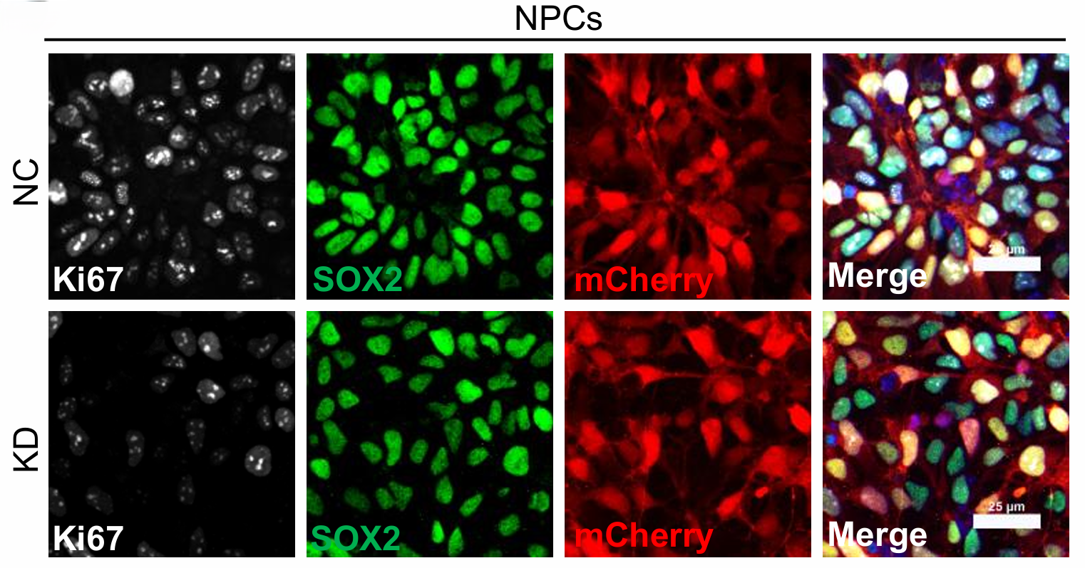 RNA-binding protein identified as key regulator of brain development
