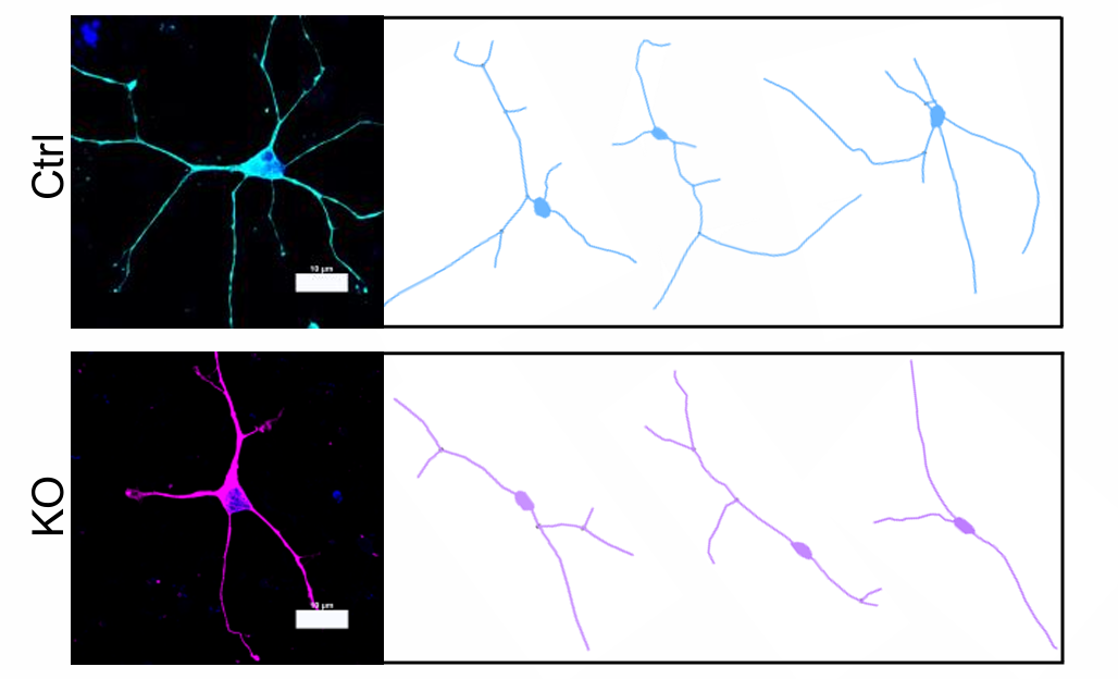 Image and sketches recreating cells with (top) and without (bottom) FXR1, showing reduced differentiation in FXR1-deficient cells