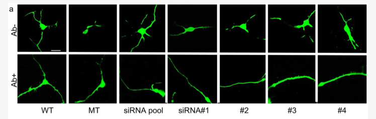 New screening platform accelerates search for Rett syndrome treatments and reveals new disease mechanisms